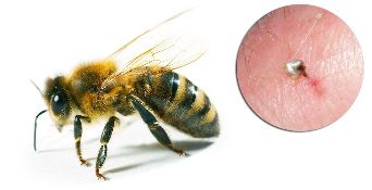 The Hondrostrong included bee venom, which improves the metabolism in tissues