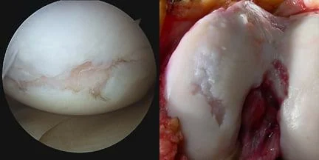 the image of the surface of the knee