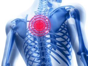 Osteochondrosis of the chest region