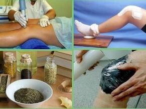 Arthritis treatment methods