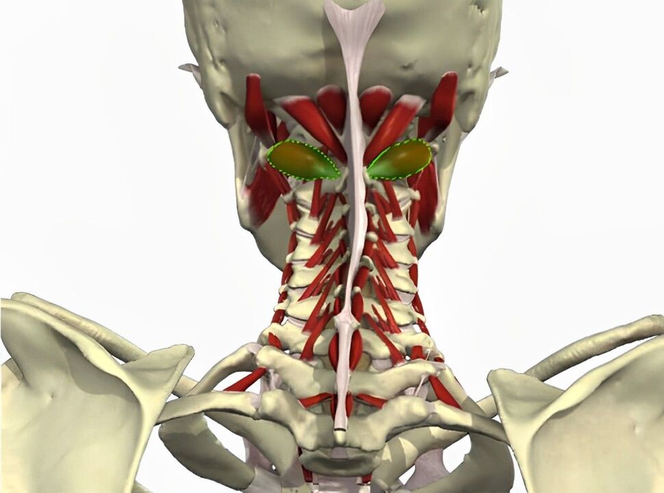 Vertebral artery syndrome