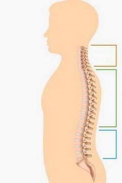 Defeat osteochondrosis of different parts of the spine